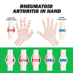 Green Bee Venom cream supporting cartilage repair and joint mobility