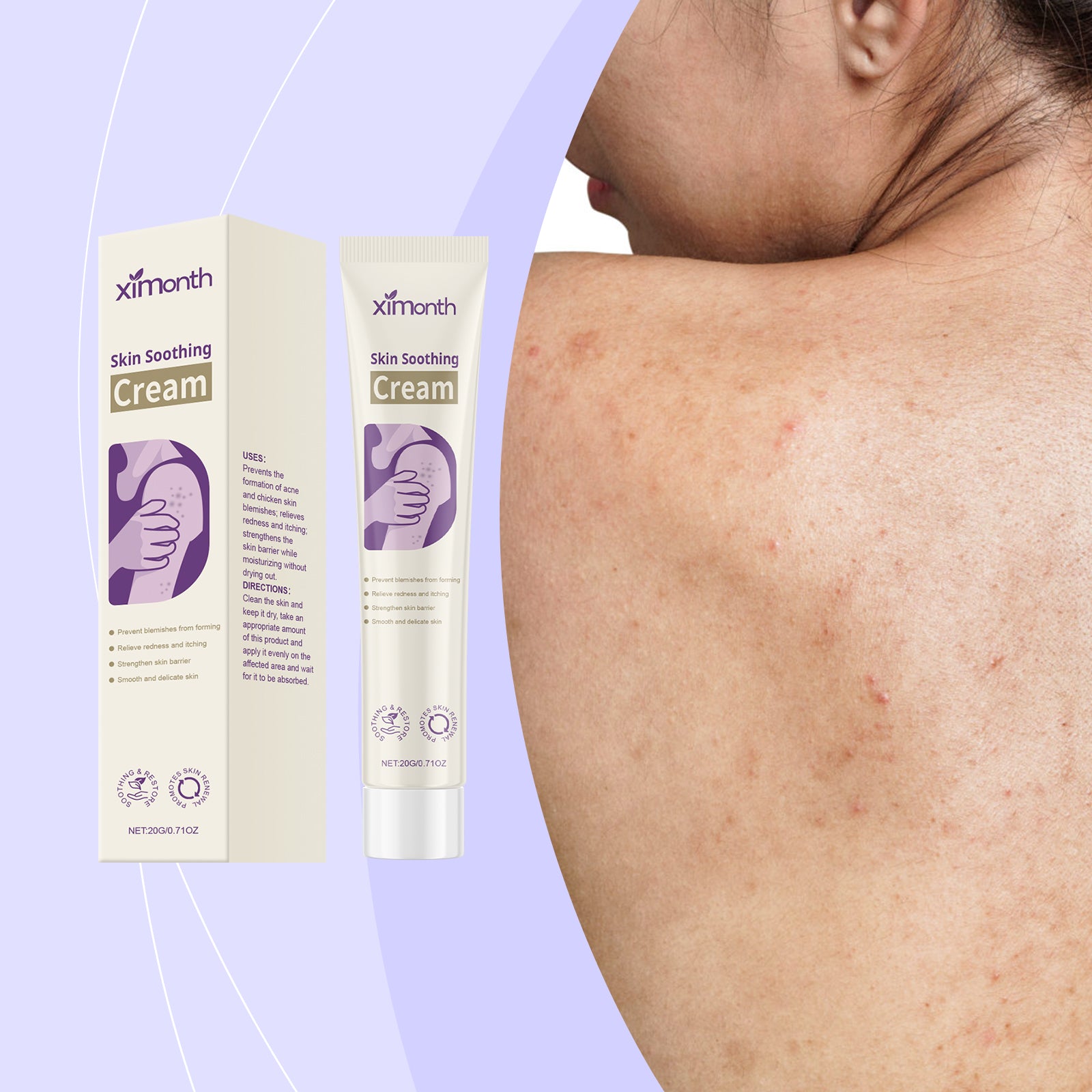 XIMONTHS acne care cream