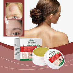 Spot care ointment with centella and ginger