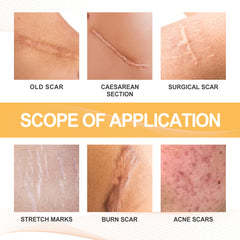 Bee venom spray for mature scar appearance