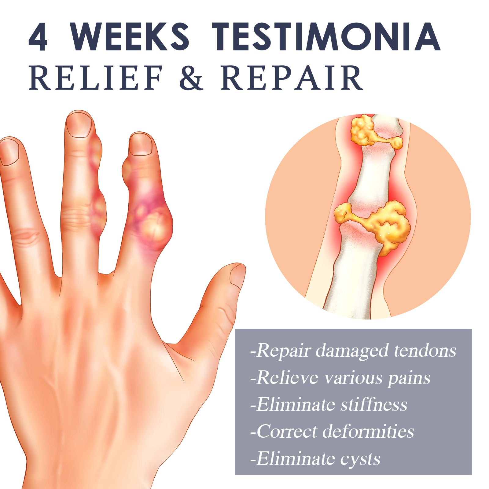 Bee Venom Joint Spray for Deformities applied on hand joints for relief