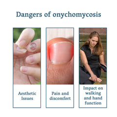 Nail fungus care product usage and nail concerns