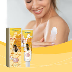 Bee venom anti-itch cream for hands and feet