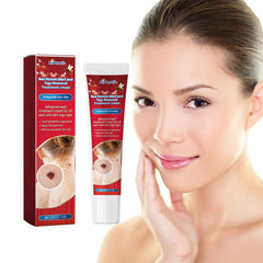 Spot care cream with salicylic acid and tea tree