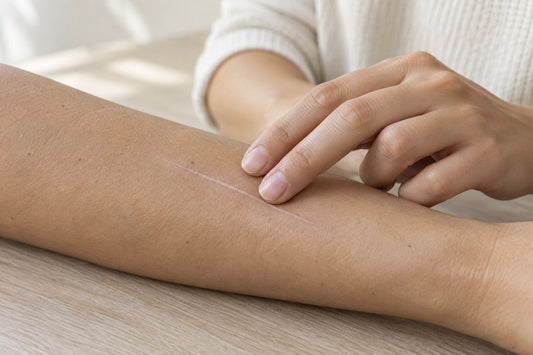 Illustration of fingertips resting gently beside a fully healed, flat forearm scar