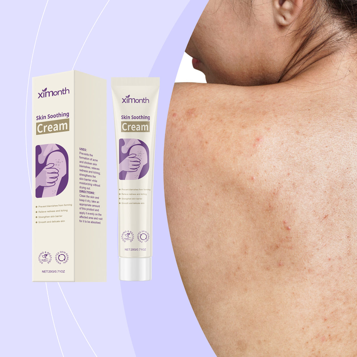 XIMONTHS acne care cream