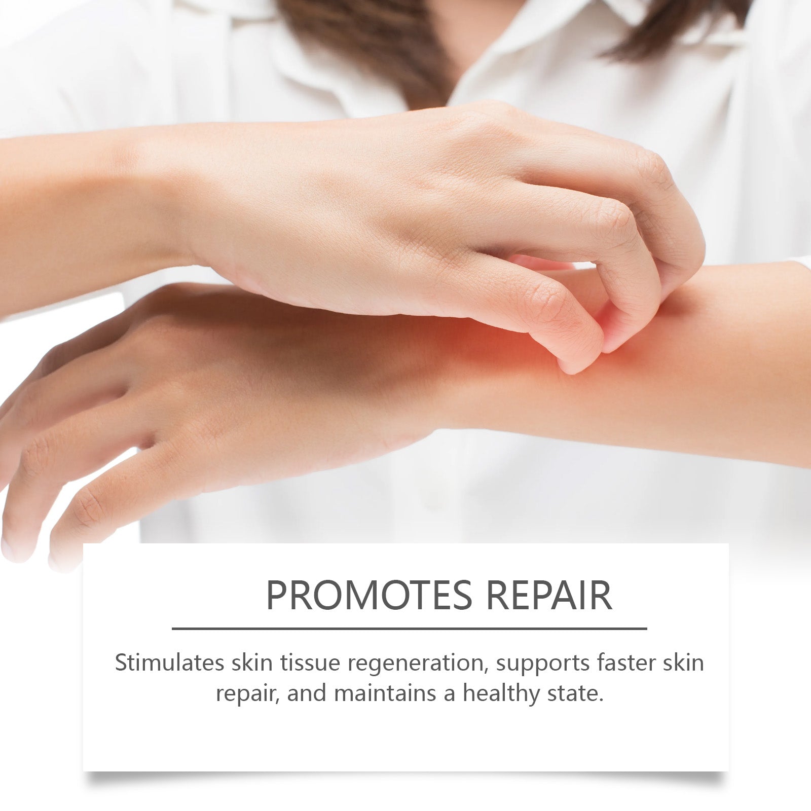 Bee venom cream with vitamin E and salicylic acid