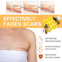 Peptide mist for stretch-mark skin care