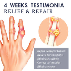 Bee Venom Joint Spray for Deformities applied on hand joints for relief