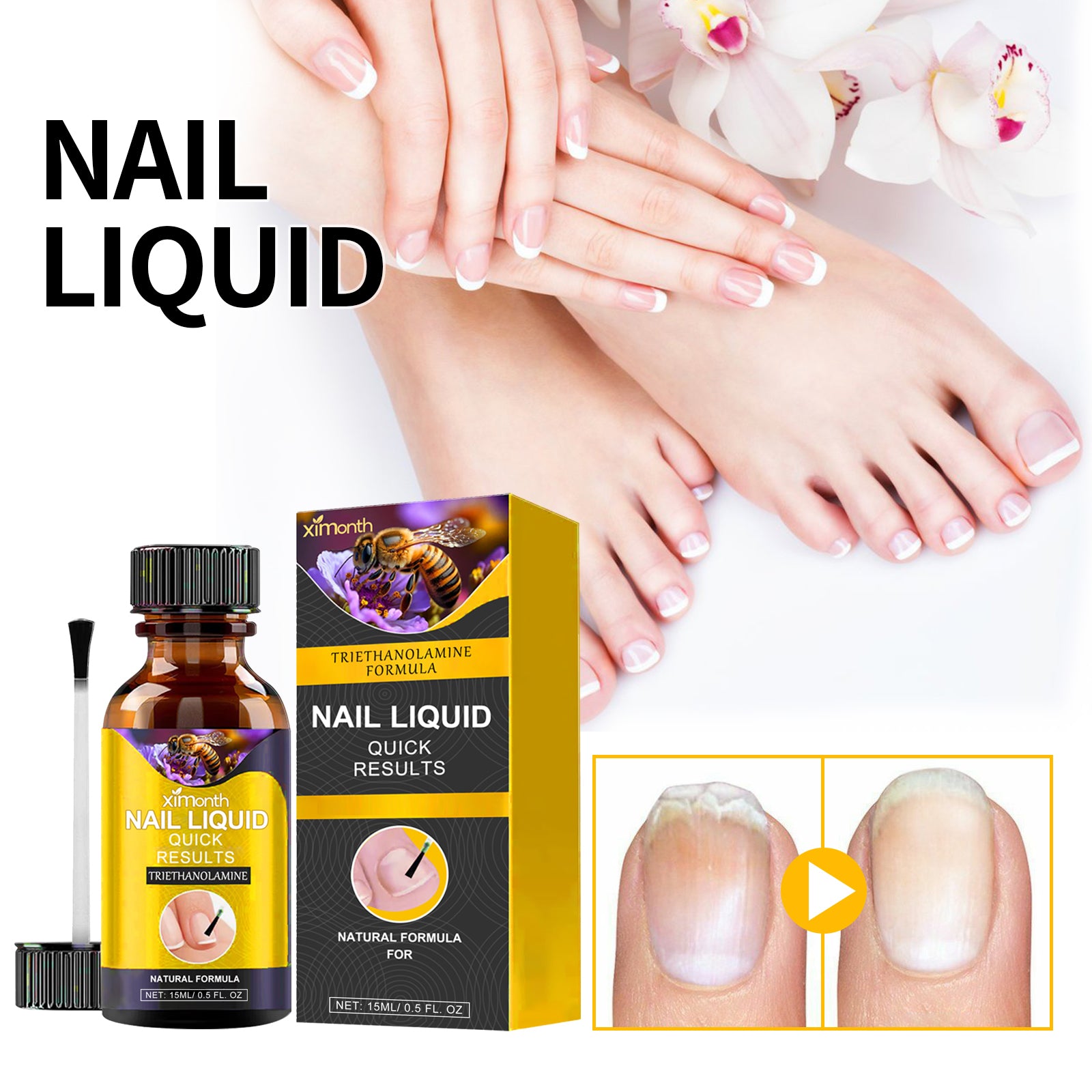 Nail liquid bottle beside hands, feet and a nail comparison illustration