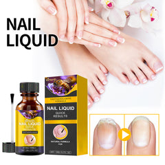 Nail liquid bottle beside hands, feet and a nail comparison illustration
