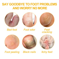 Supplied artwork illustrating foot and nail-care concerns