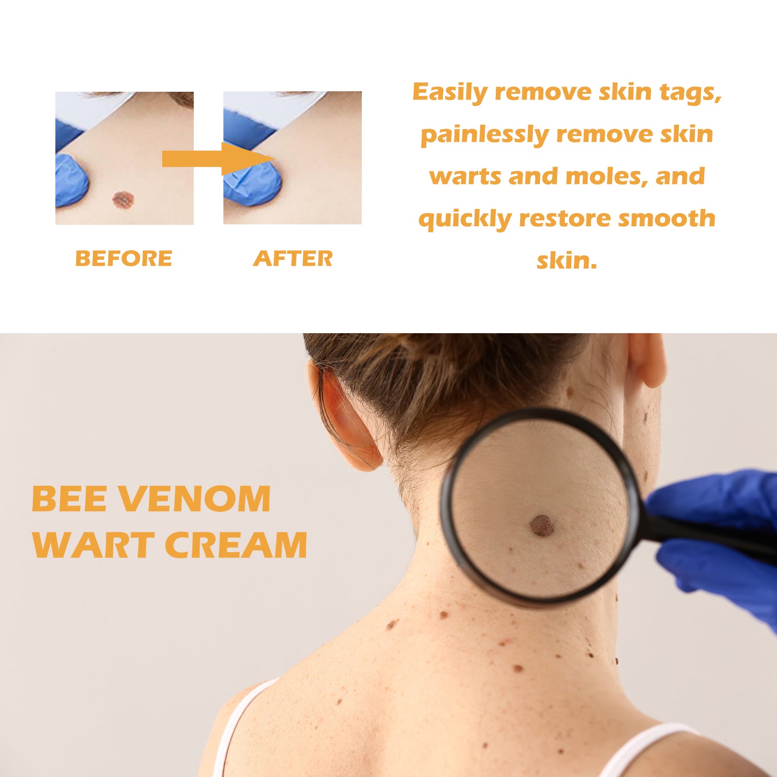 Bee venom wart cream smooth skin care positioning
