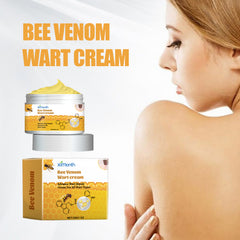 Wart cream jar and carton beside a skin-care lifestyle scene