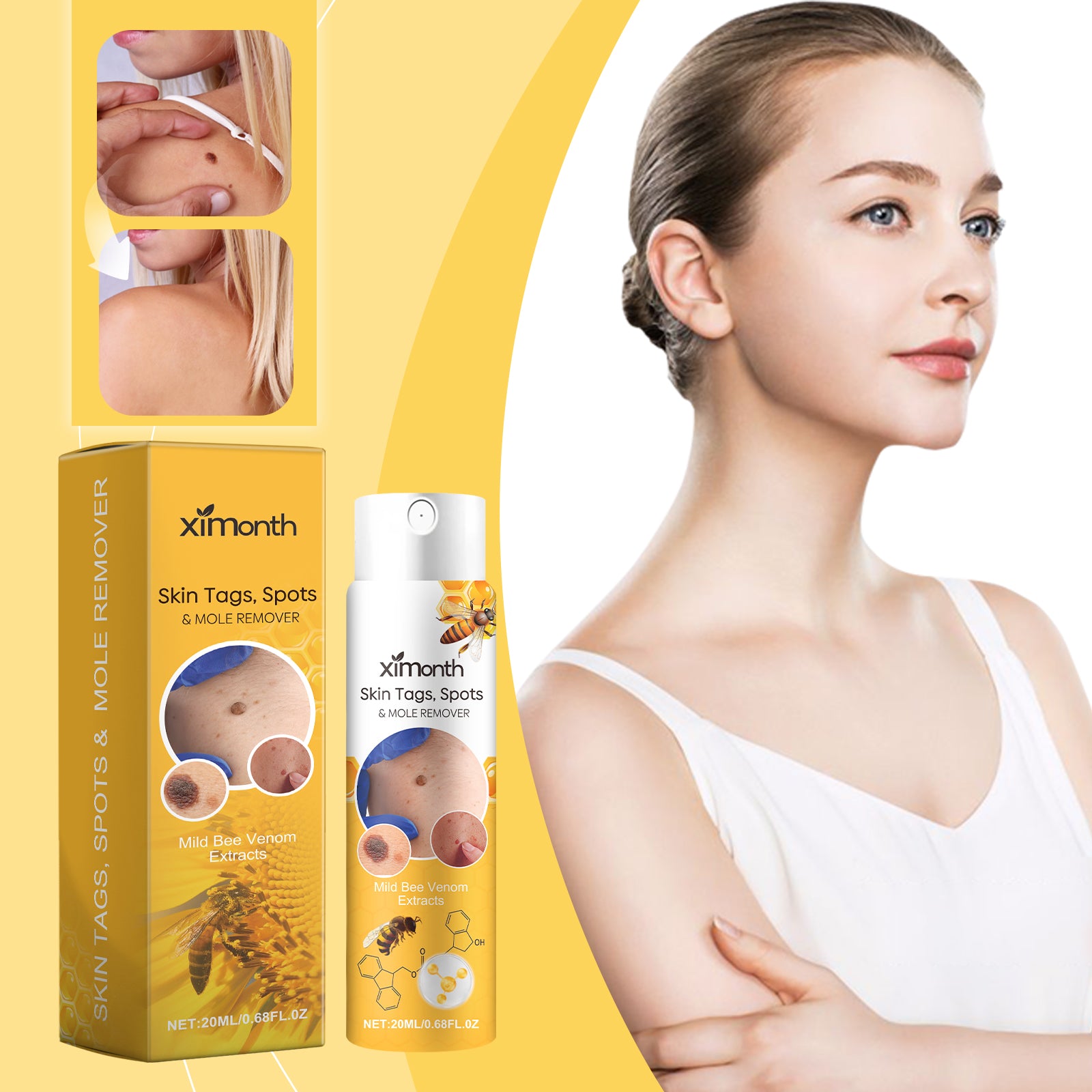Portable wart care spray for gentle topical use