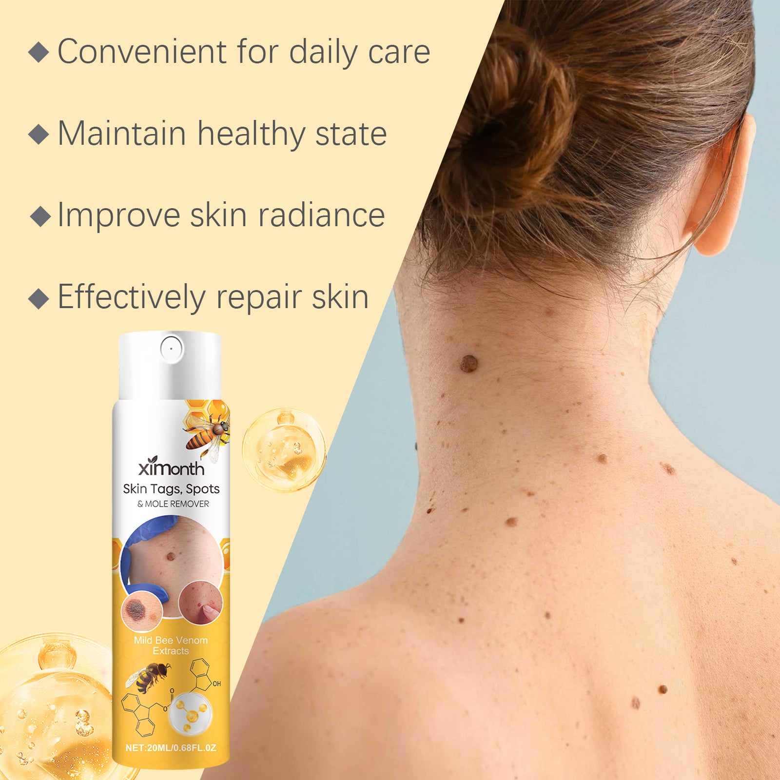 Lightweight wart-care spray bottle