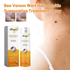 Wart spray packaging beside a close-up skin-care scene