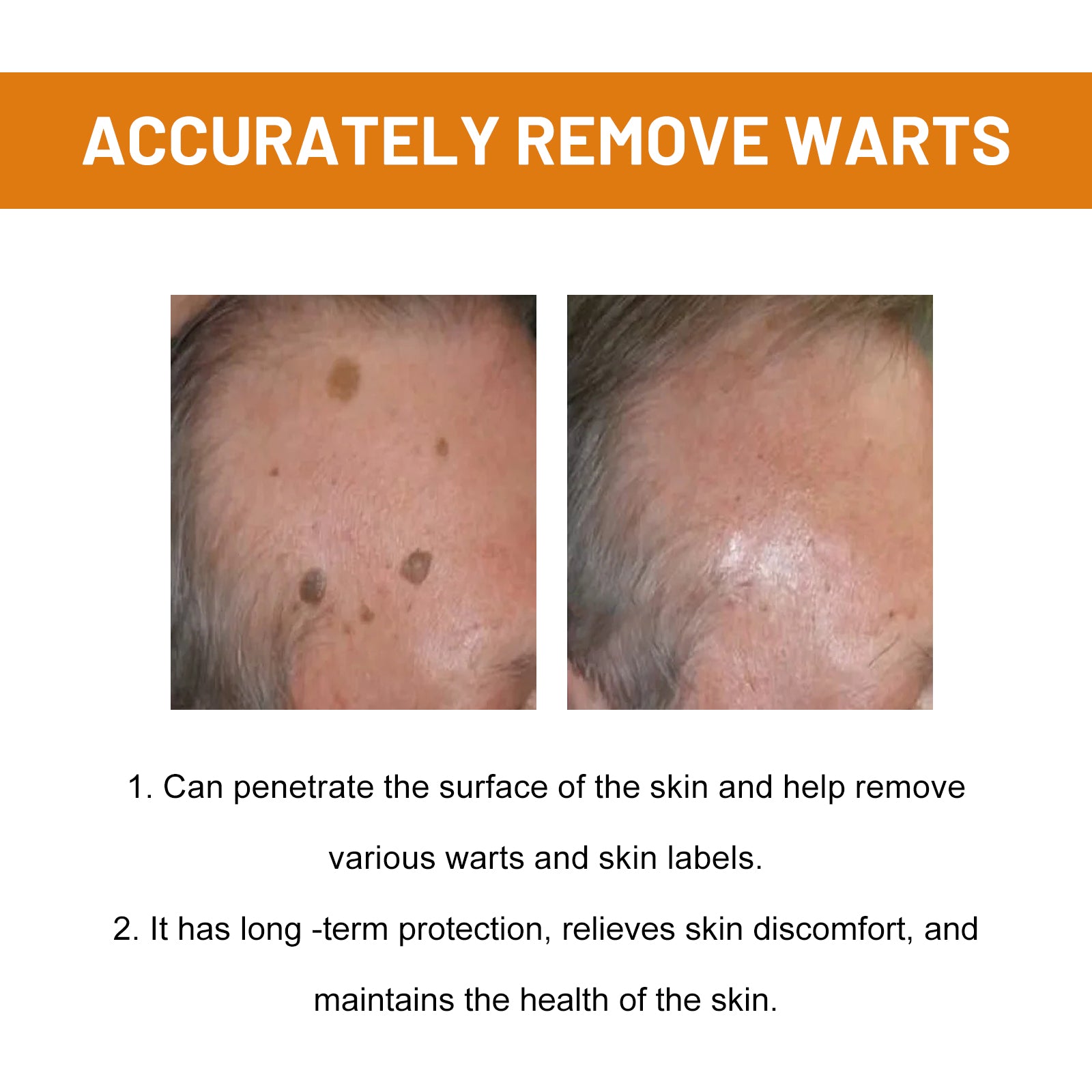 Promotional wart-care comparison images supplied with the spray