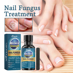 Topical nail care solution for thick or discolored nails