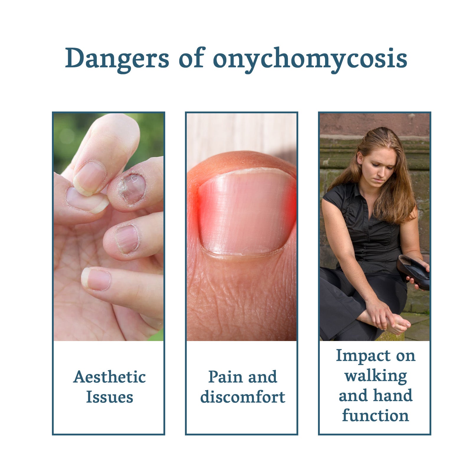 Nail fungus care product usage and nail concerns