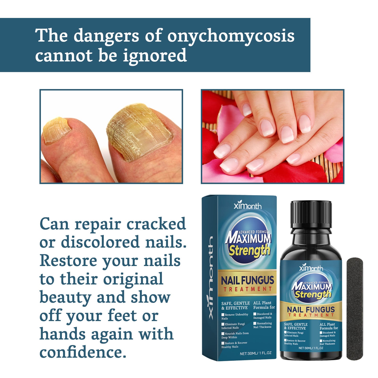 Nail treatment ingredients including tea tree and jojoba oils