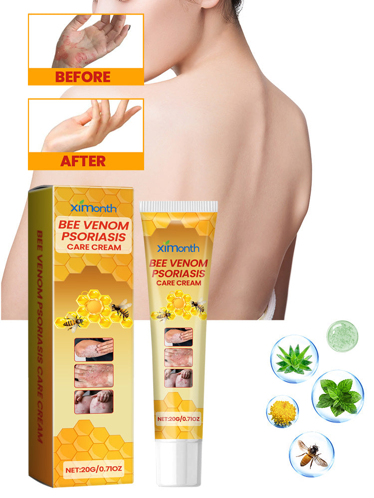 Bee venom cream for dry itch-prone skin