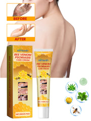 Bee venom cream for dry itch-prone skin