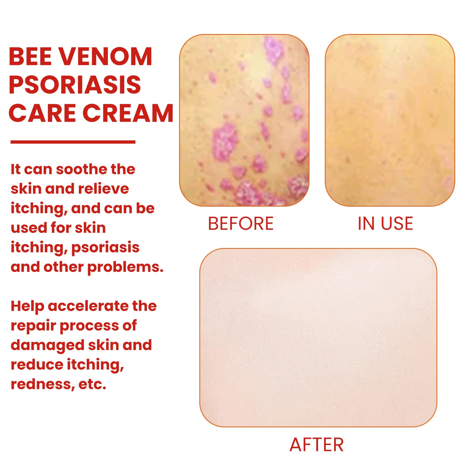 Skin comfort cream with mint leaf oil