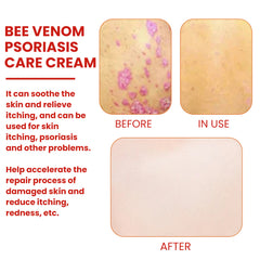 Skin comfort cream with mint leaf oil