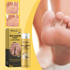 Foot spray bottle beside a foot and heel-care illustration