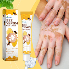 White-spot care cream tube beside hands with uneven pigmentation