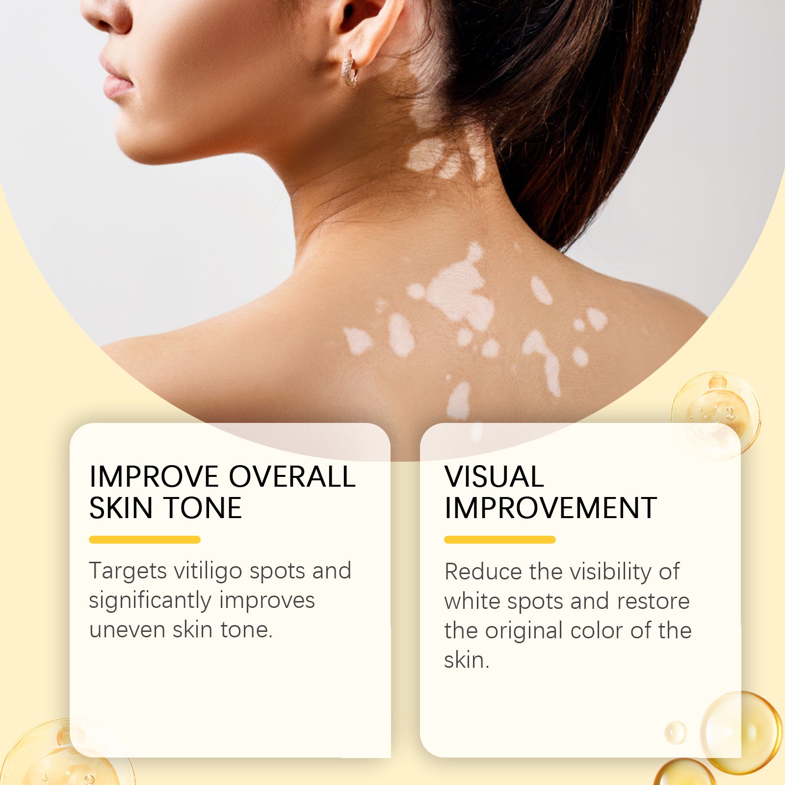 Shoulder and neck with white patches in the cream artwork